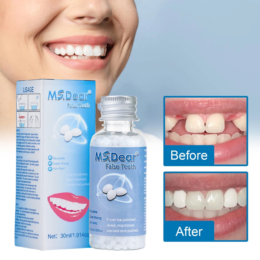 30ml Moldable False Teeth Dentures Adhesives Making Veneers Plastic Rubber Temporary Teeth Gaps Broken Repair Dental Beauty Tool