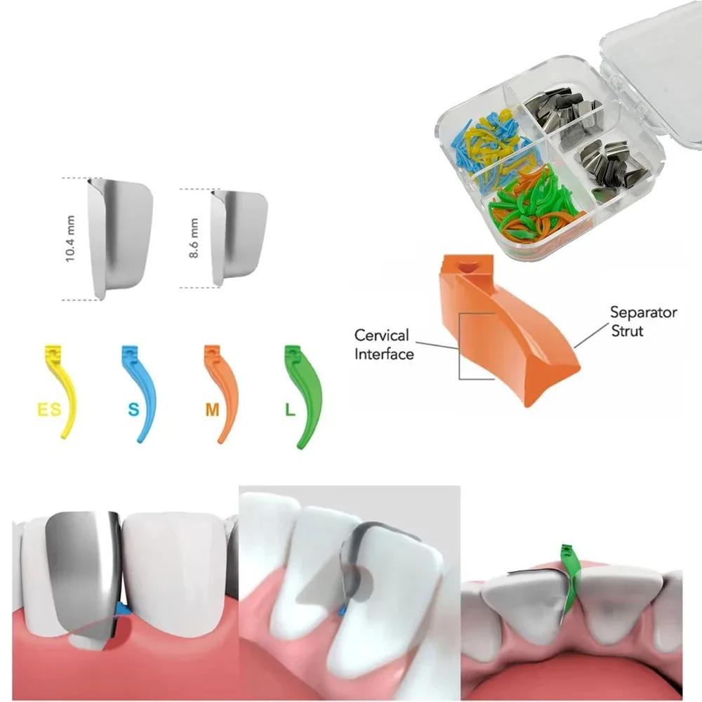 1Box Dental Anterior Matrix System Wedge Matrix Bands Interdental Wedges Dentistry Supplies Oral Materials