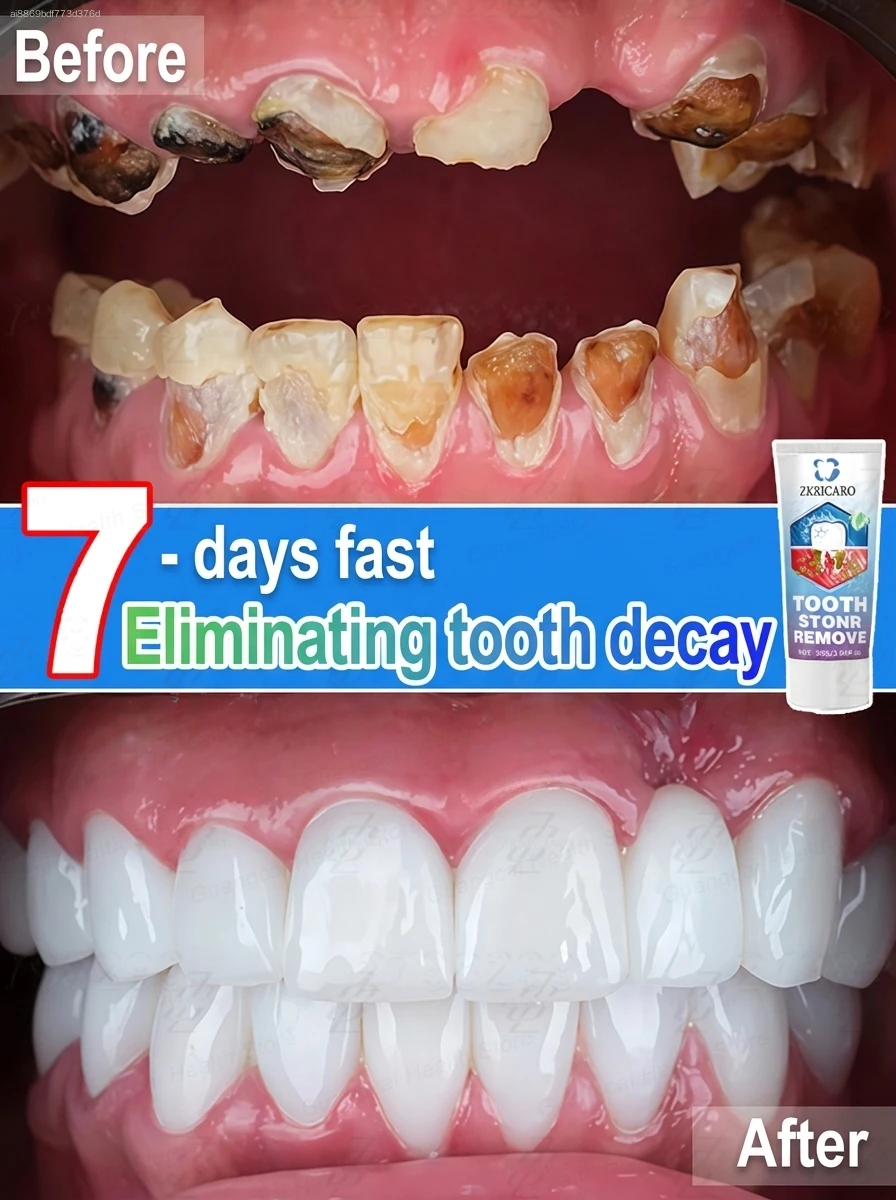 

Say Goodbye to Cavity Pains Gentle Oral Care