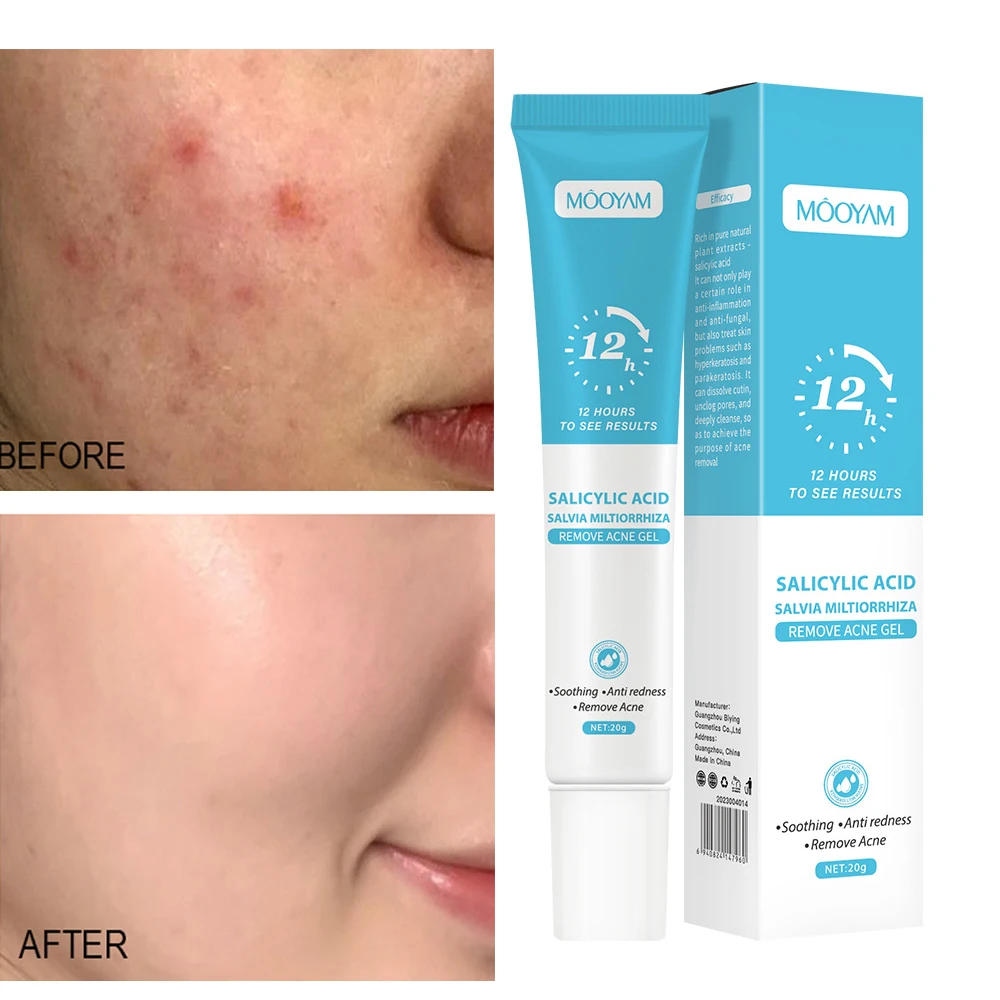 

Rapid Relief Acne Treatment Cream Salicylic Acid Clear Gel Acne Remover Acne Scar Cream Oil Control Shrink Pores Whitening Skin