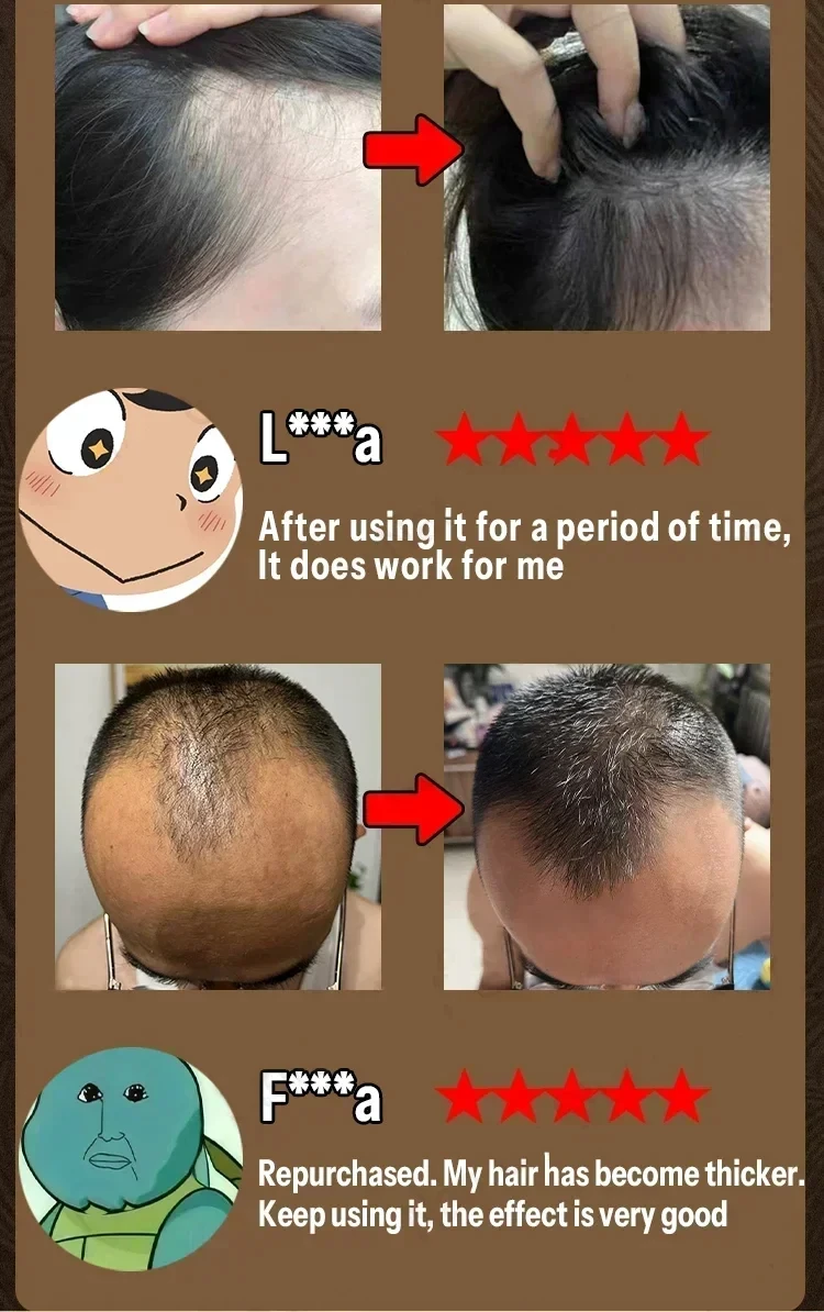 Unisex Hair Growth Oil Hair Loss Treatment Rapid Hair Growth Effective Baldness Repair Hereditary PostpartumHair Loss