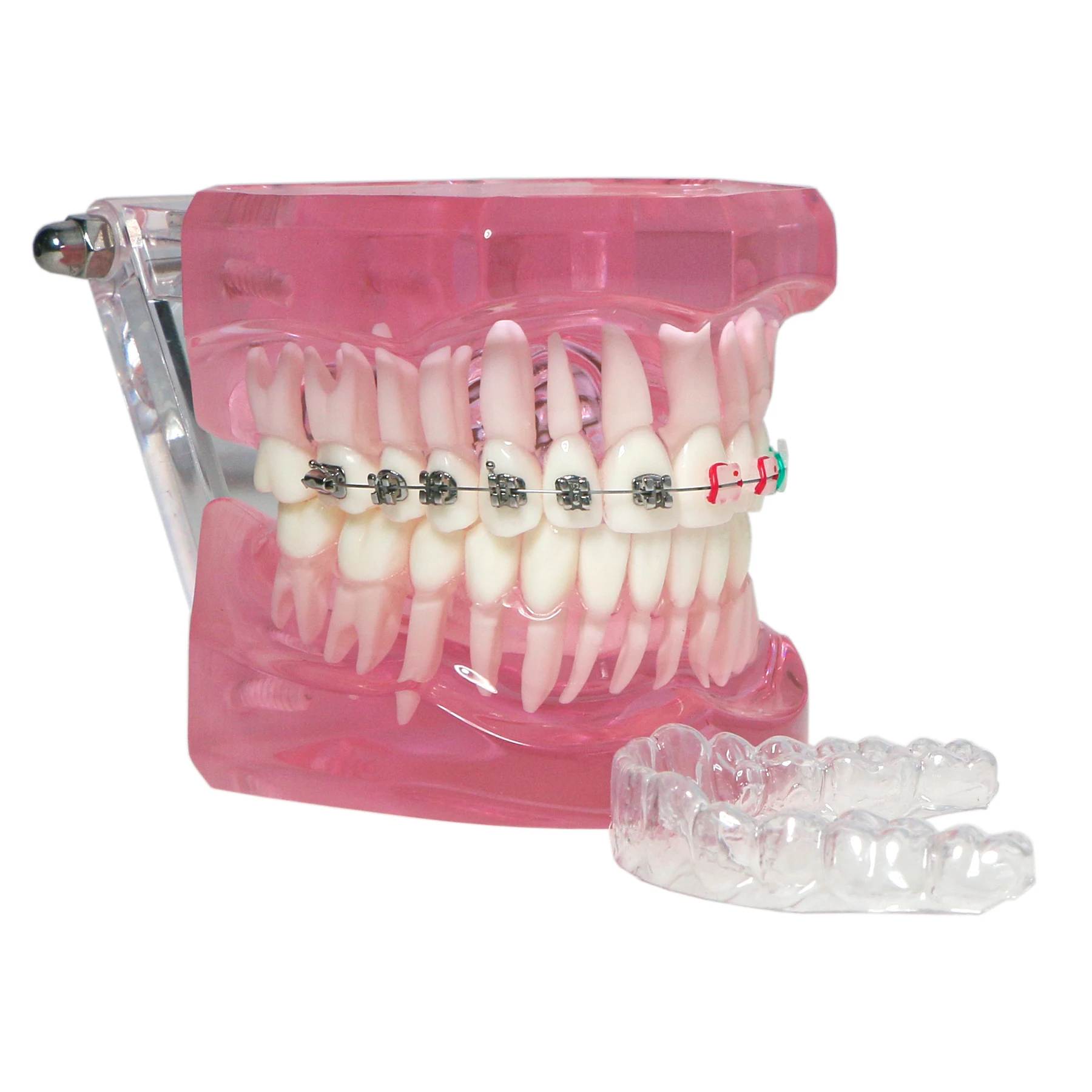 Dental Teaching Model Orthodontic With Ceramic Lingual Retainer Metal M3012 Ceramic Bracket Demo