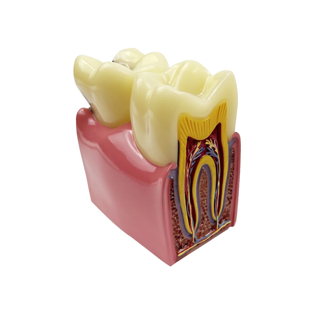 Model zębów Model porównania próchnicy stomatologicznej dla praktyki technika dentystycznego studiowania narzędzi stomatologicznych