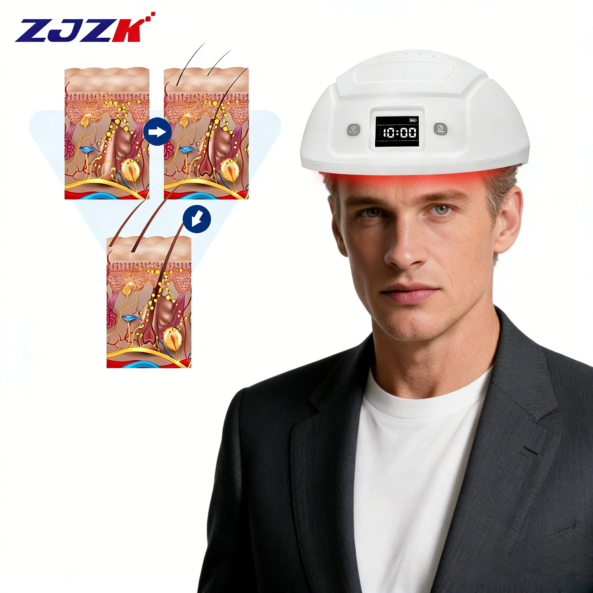 

2026Safe Red Light Laser Hair Treatment Device for Receding Hairline Temple Seborrheic Alopecia and All Age Hair Loss