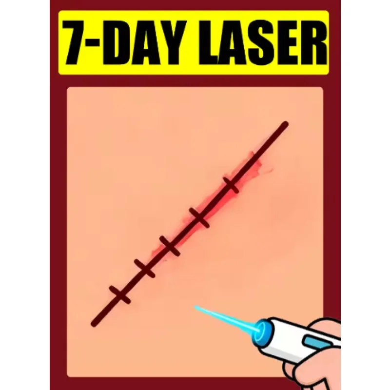 

Лазерные ручки двуго поколения для решения проблем шрамов и здоровья кожи.