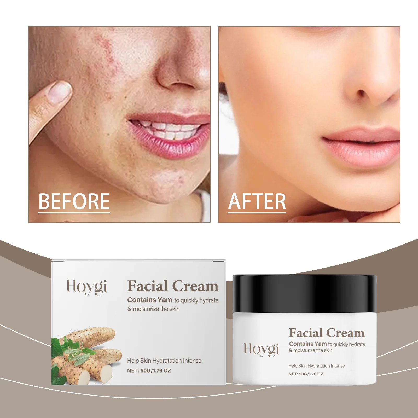 Crème pour le visage – Hydratant à hydratation intense pour peaux sèches et déshydratées