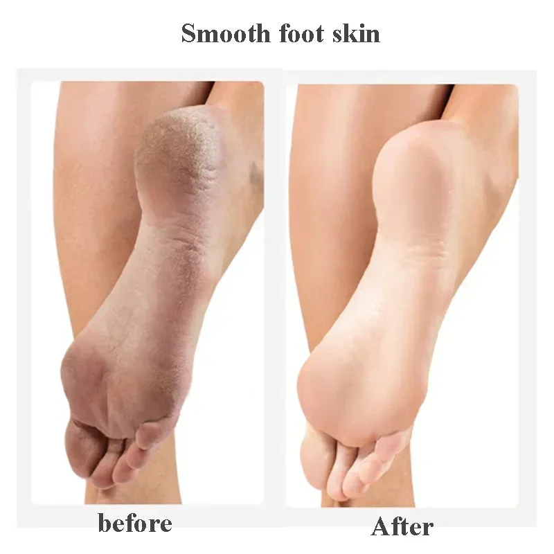 両面フットファイルフットやすりペディキュアツール足角質カルスリムーバー木製ハンドルフットスクラバーサンドペーパー健康