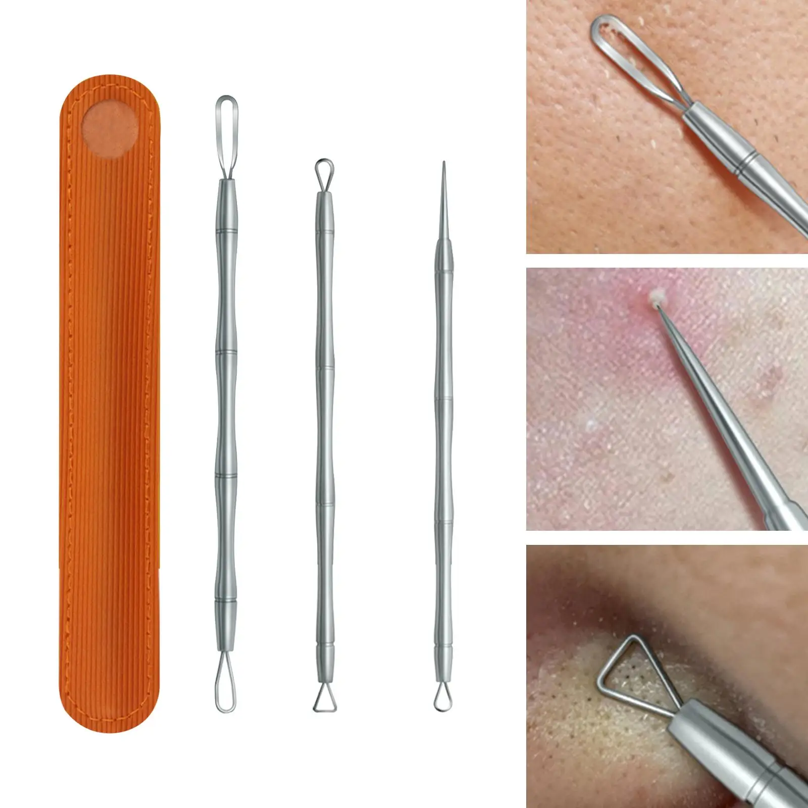 Kit removedor de cravo de aço inoxidável, conjunto de ferramentas extrator de dupla face para cuidados com remoção de espinhas faciais