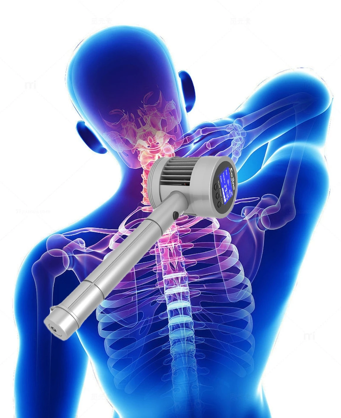 

Аппарат для глубокой лазерной терапии (LLLT) с двойной волной 650 нм и 808 нм для лечения боли в плечах, шее, спине и растяжений