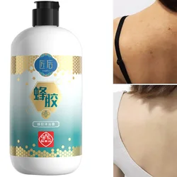 Gel de ducha con propóleo, limpieza profunda y calmante para la piel, Gel de ducha refrescante y blanqueador corporal, elimina la piel de pollo, 400ml/16,9 OZ