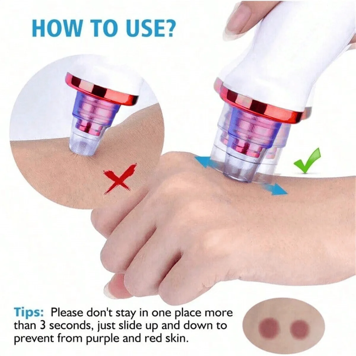 Usuwacz zaskórników Usuwanie pryszczy i trądziku Narzędzie próżniowe do usuwania zaskórników Pielęgnacja skóry Środek do czyszczenia porów