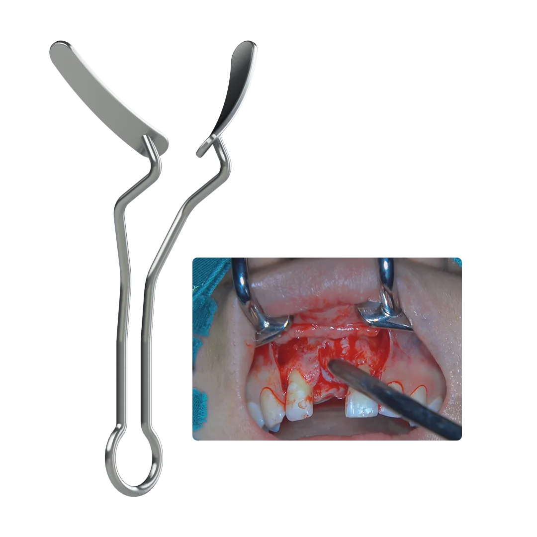 Oral Commisure Retractor Dental Surgical Instruments