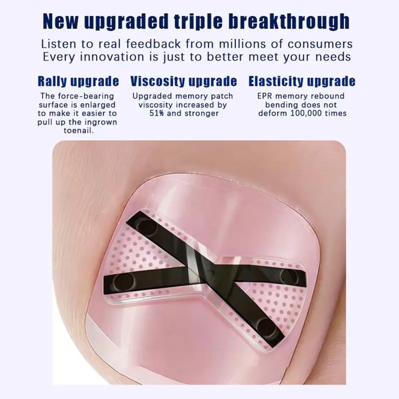 X-shaped Ingrown Toenail Correction Tool Ingrown Toenail Treatments Elastic Patch Sticker Toenail Straightening Pedicure Tool