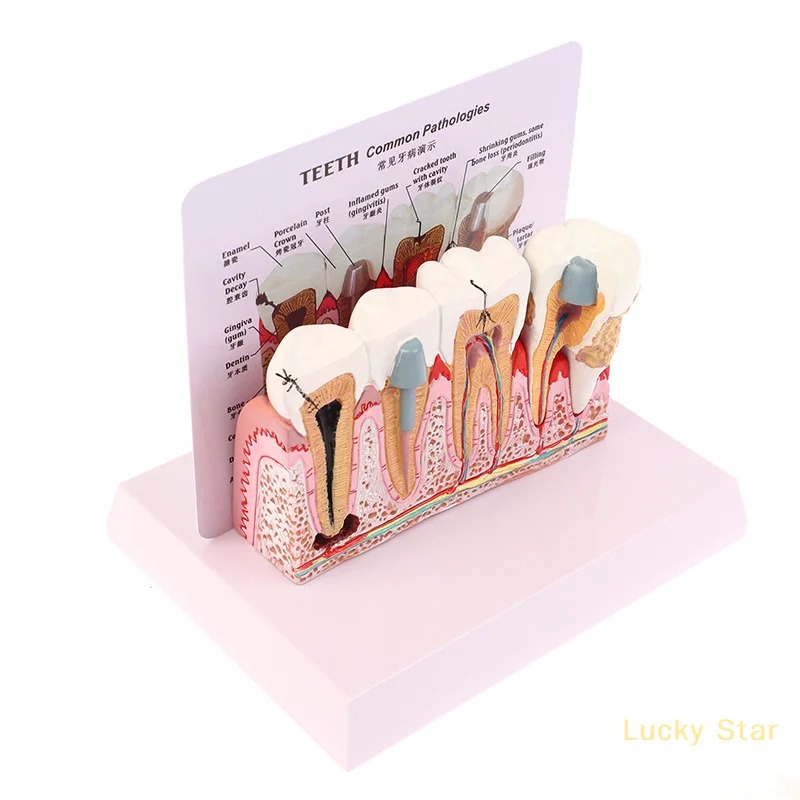 Standard Dental Oral Teeth Anatomical Teaching Model Comprehensive Tooth Structure Model Dentist Dental Student Demonstration
