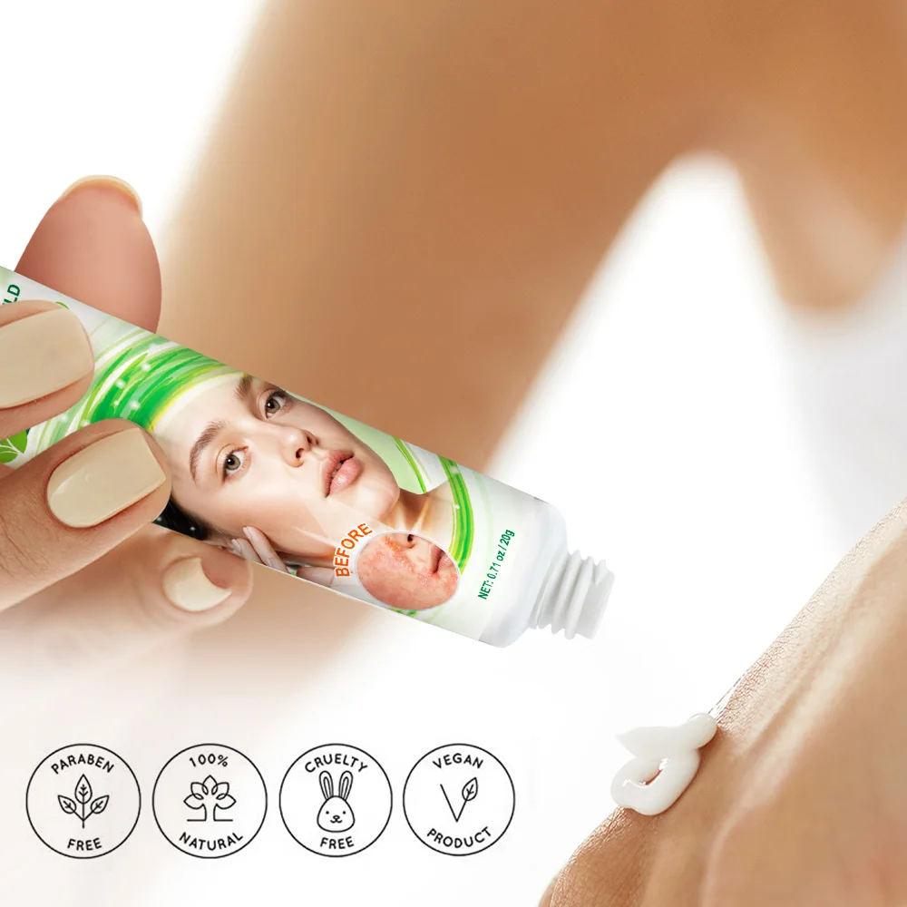 Рисунок 5 - 20 г/коробка Sumifun крем от себорейного