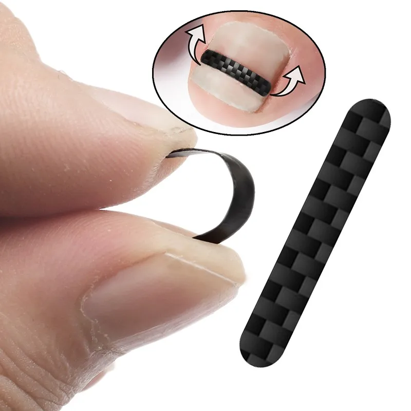 Herramienta de corrección de uñas encarnadas, Clip alisador, tratamiento de uñas de los pies, parche elástico adhesivo, herramienta de cuidado de pedicura, 1/10 Uds.