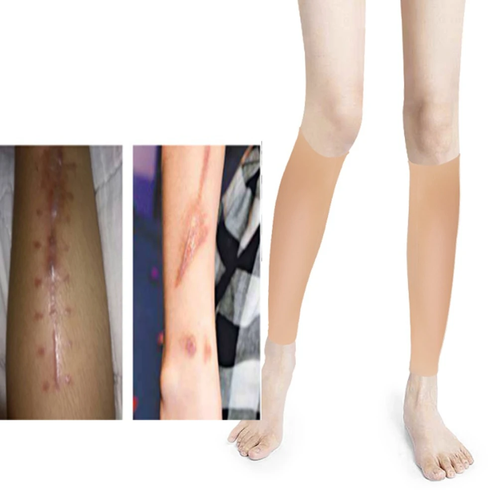 Cicatrices de panturrilha, cobertura de marca de nascença, capa de perna de beleza de silicone, almofada de panturrilha, ortopédicos, capa de pele falsa de silicone para braço.