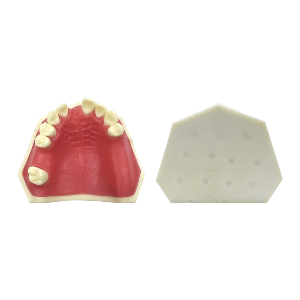 Modèle d'implant dentaire fuchsia, modèle de pratique du sinus maxillaire, dent manquante, étudiant dentiste, démonstration d'étude