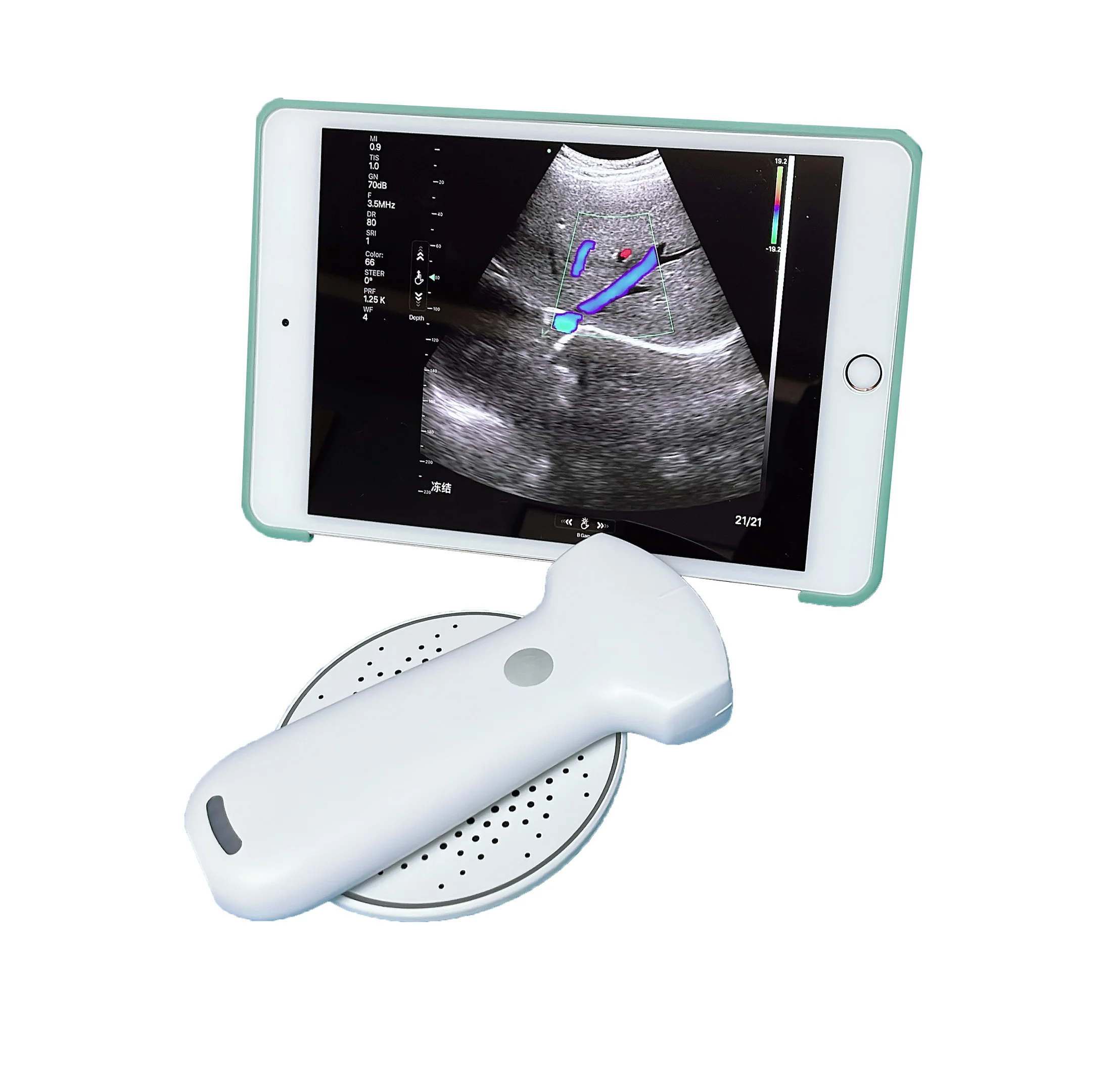 MSLPU94 192 elements Wireless Portable(Handheld) Color Doppler Ultrasound Probe Convex probe