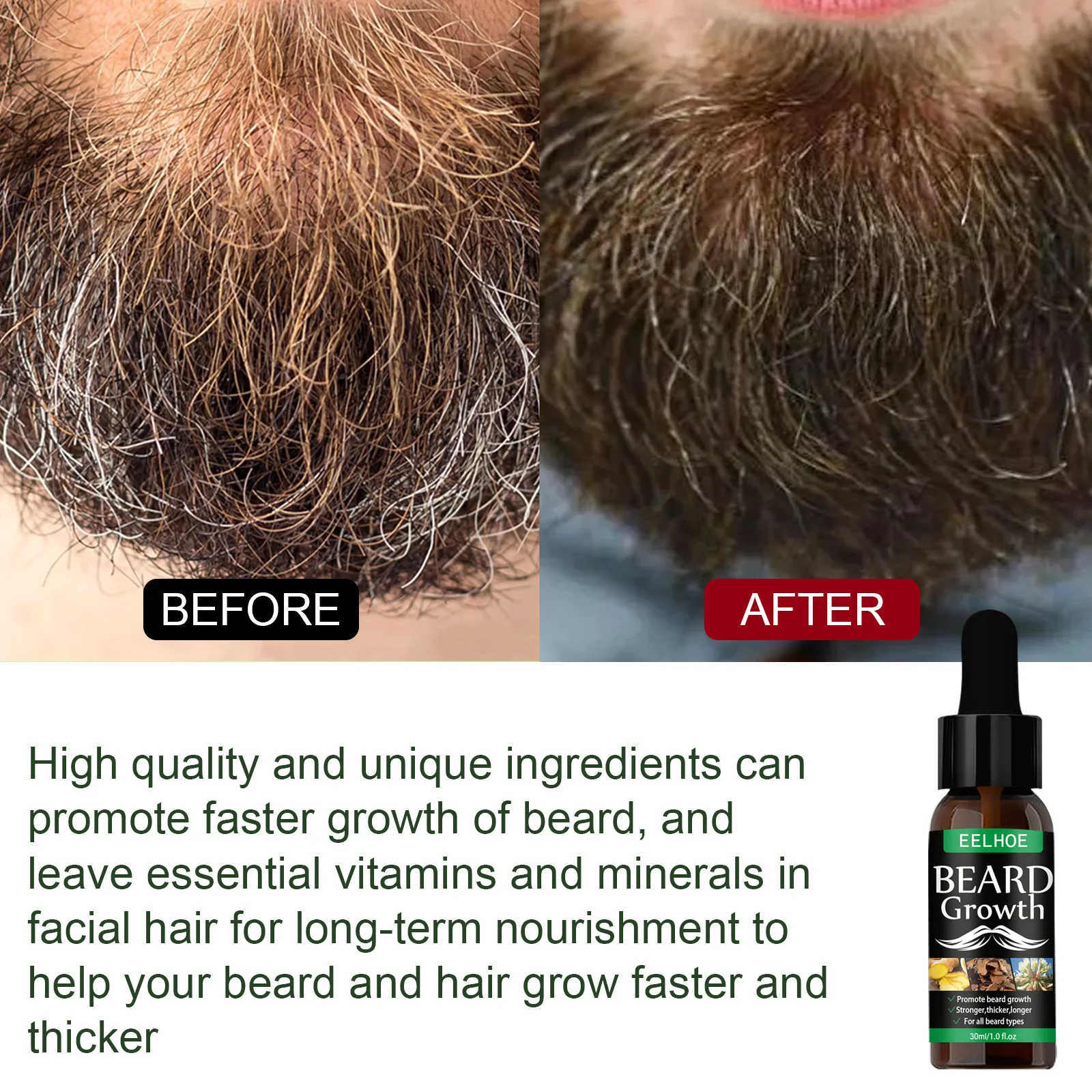 Beard Growth Oil, Nourishing Moisturizing Spray Beard Care Boosting Beard Growth Condenser