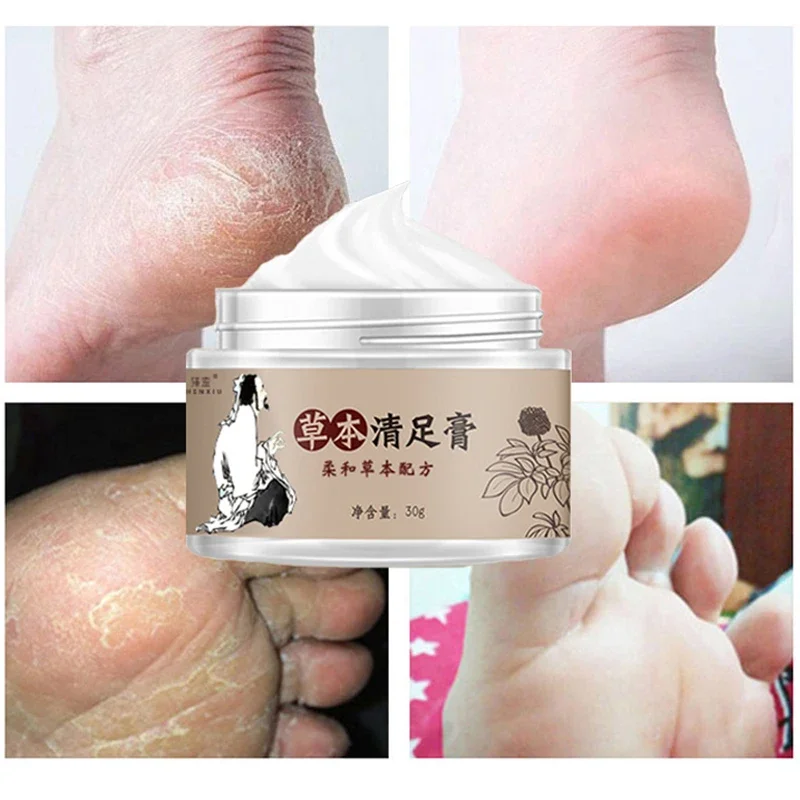 Anti Crack Foot Cream piedi Peel Mask Heel Cracked Dry Repair creme rimozione Peeling per le mani Callus prodotti per la cura della pelle morta 30ml