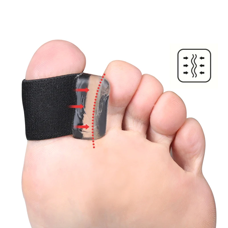 Grand séparateur de pouce et de valgus Parker, l'offre elles intérieures, séparation d'anneau, ration hallux valgus, coussretours de soin des pieds, orthèses pour orteils chevauchants, 1 paire