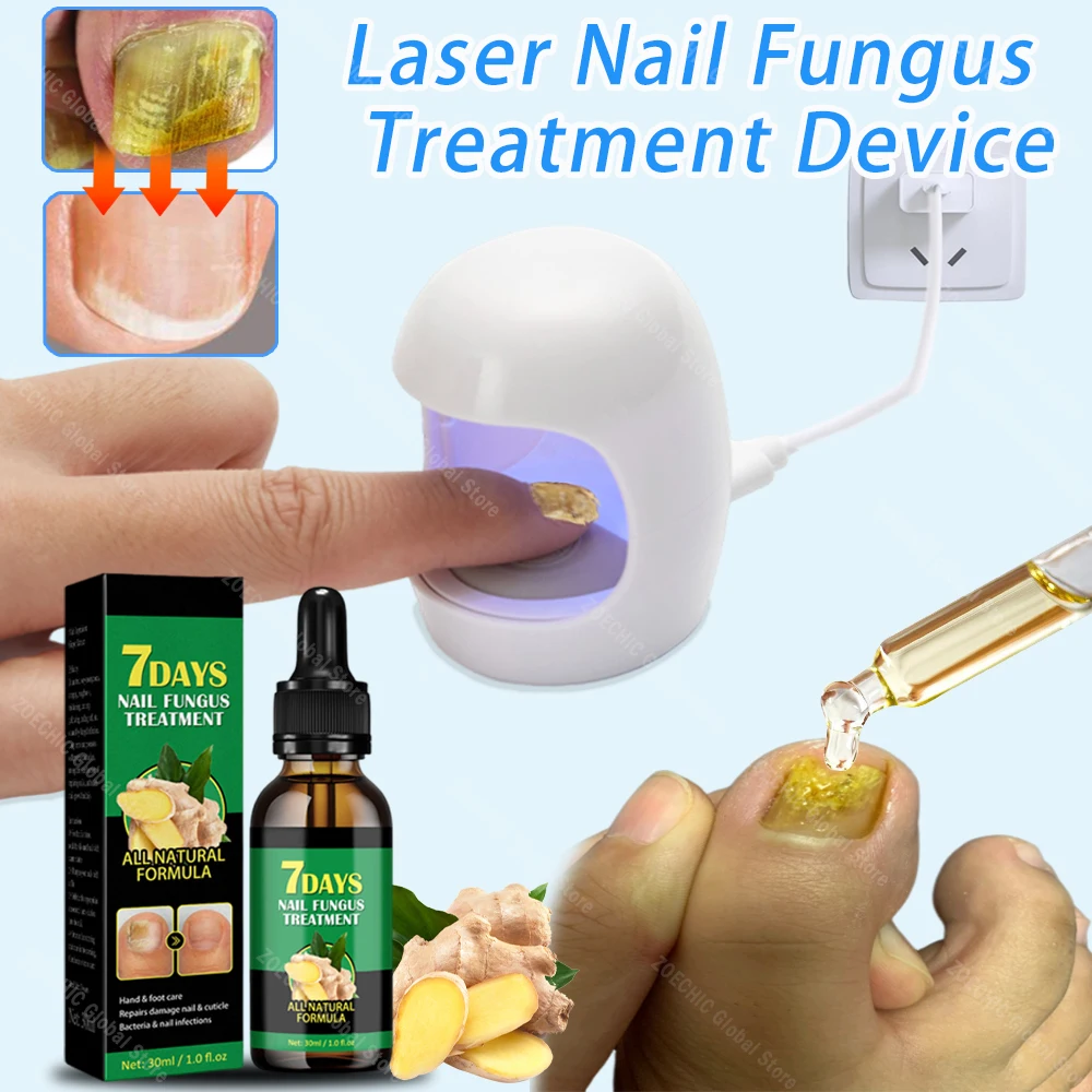 

Toenail Nail Fungus Treatment Repair Fingernail Device Toenail Treatment for Foot Nail Fungus Essential Oil Onychomycosis Care