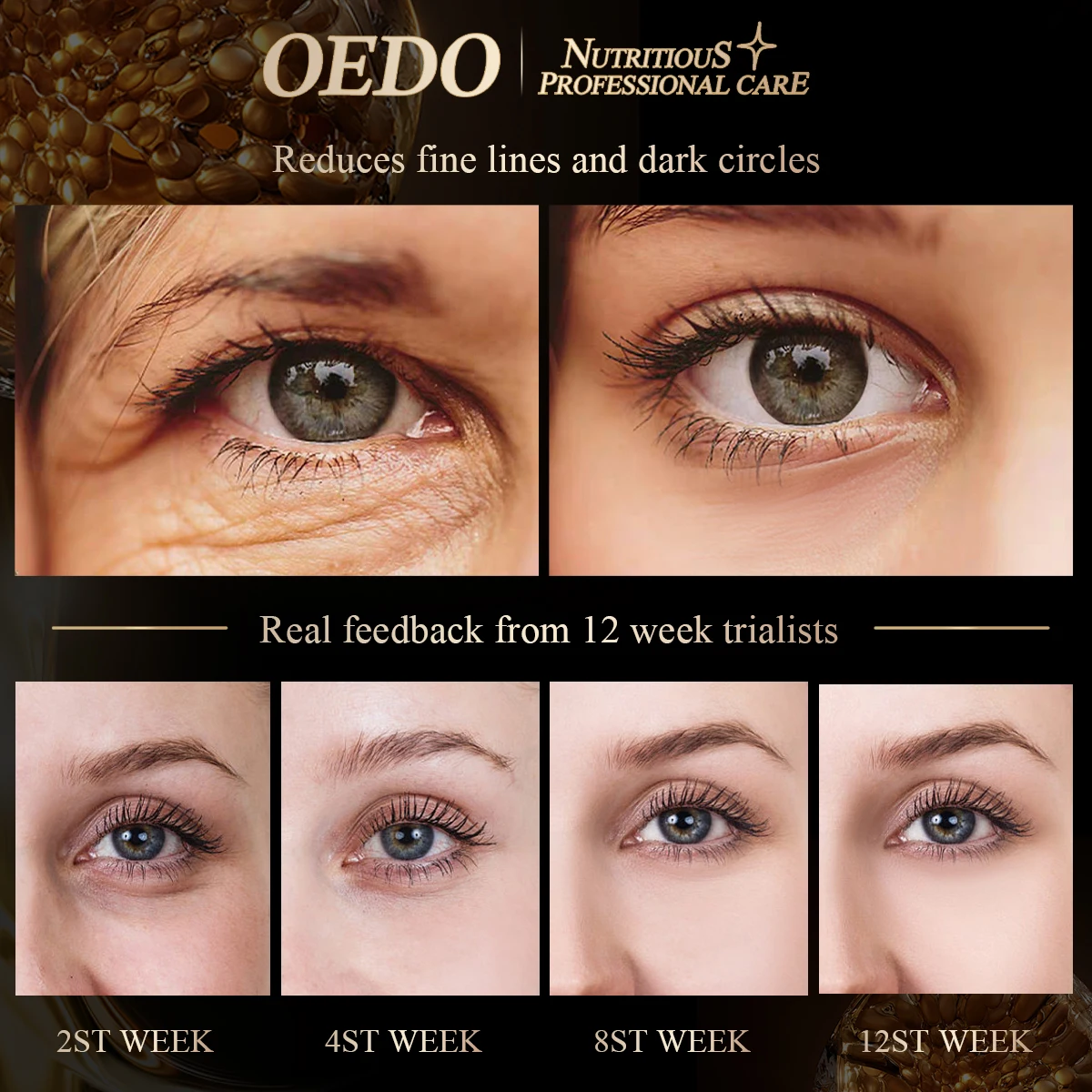 OEDO Anti Aging Eye Cream Against Bags And Puffiness Eye Care Dark Circle Remover Anti-Wrinkle Eye cream