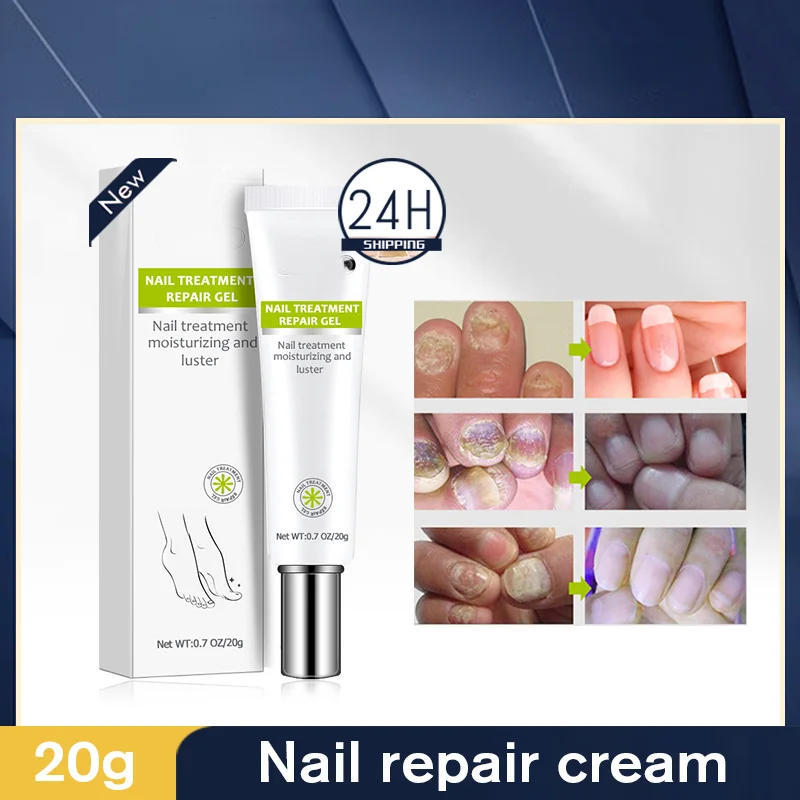 Buy 1 Get 1 Nail Repair Nourishing Brighten Foot Finger Care Nail Serum Nail Cream Women Men Nails Products