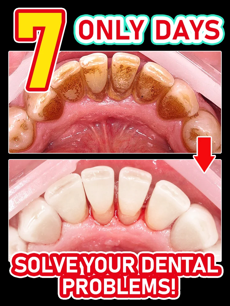 

Teeth fresh breath, green packaging, strong teeth