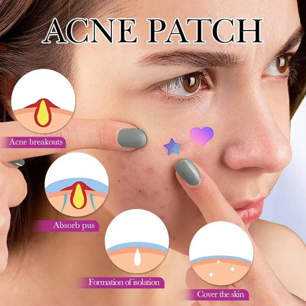 Laser Star Combination Acne Patch Mild Non-irritant Muscle Improve Acne Care Lightening Acne Patch Closing Acne Acne Skin T6P4