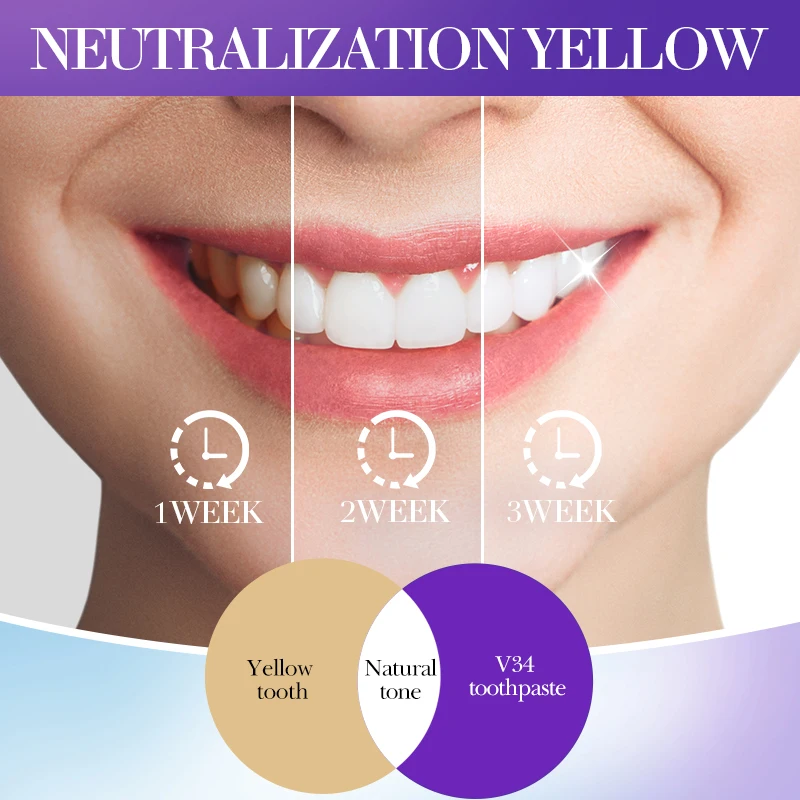 SADOER V34 Toothpaste Stain Removal for Brighter Teeth, Enamel Safe Formula Fresh Mint Fluoride Toothpaste 28/30ml