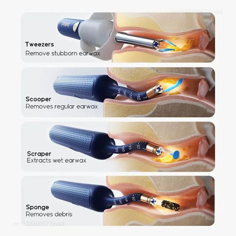비버드 이어사이트 플러스 I35R-R37R-D39R 컴팩트 올인원 시각 귀지 제거 도구 휴대용 귀 청소기 구강 내시경 카메라