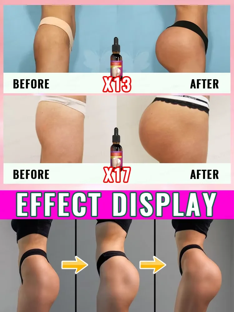 Purifies the lines of the thighs, abdomen, chest and buttocks