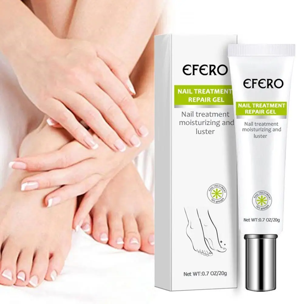 Fungal Nail Treatment Gel Foot Nail Fungus Removal Gel Anti Nails Foot Repair Gel Care Onychomycosis Infection Paronychia Y0M8