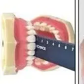 

6Pcs/set Dental Orthodontic Black Photography Background Board Photo Image Contrast Board Metal Oral Cheek Plate with Scale Tool