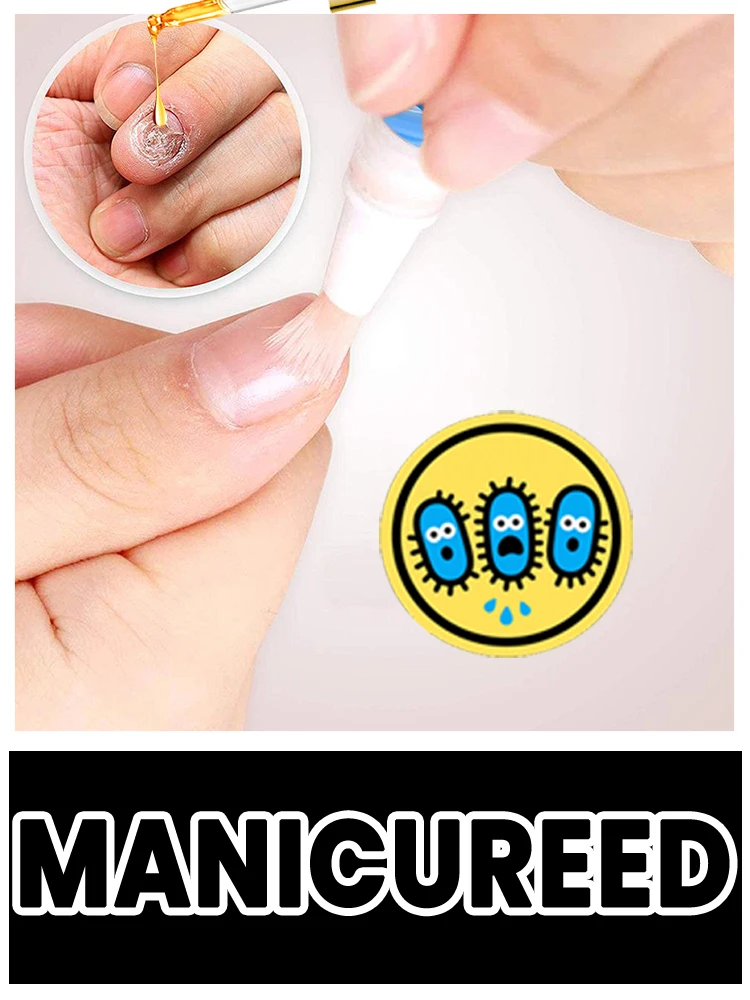 Teebaum-Nagelpflegelösung, Nagelmikrobielle Präventionstechnologie, tägliche Pflege, 10 ml