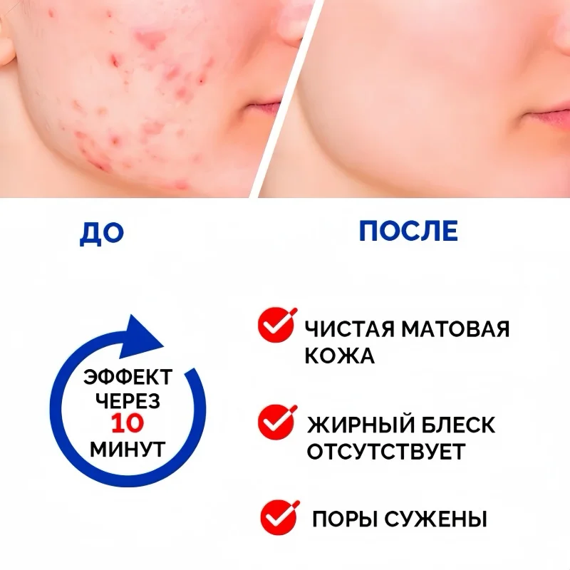 Russian Cleansing Clay Mask for Face, Deep Pore Treatment to Control Oil, Fight Acne & Tighten Pores, 75ml