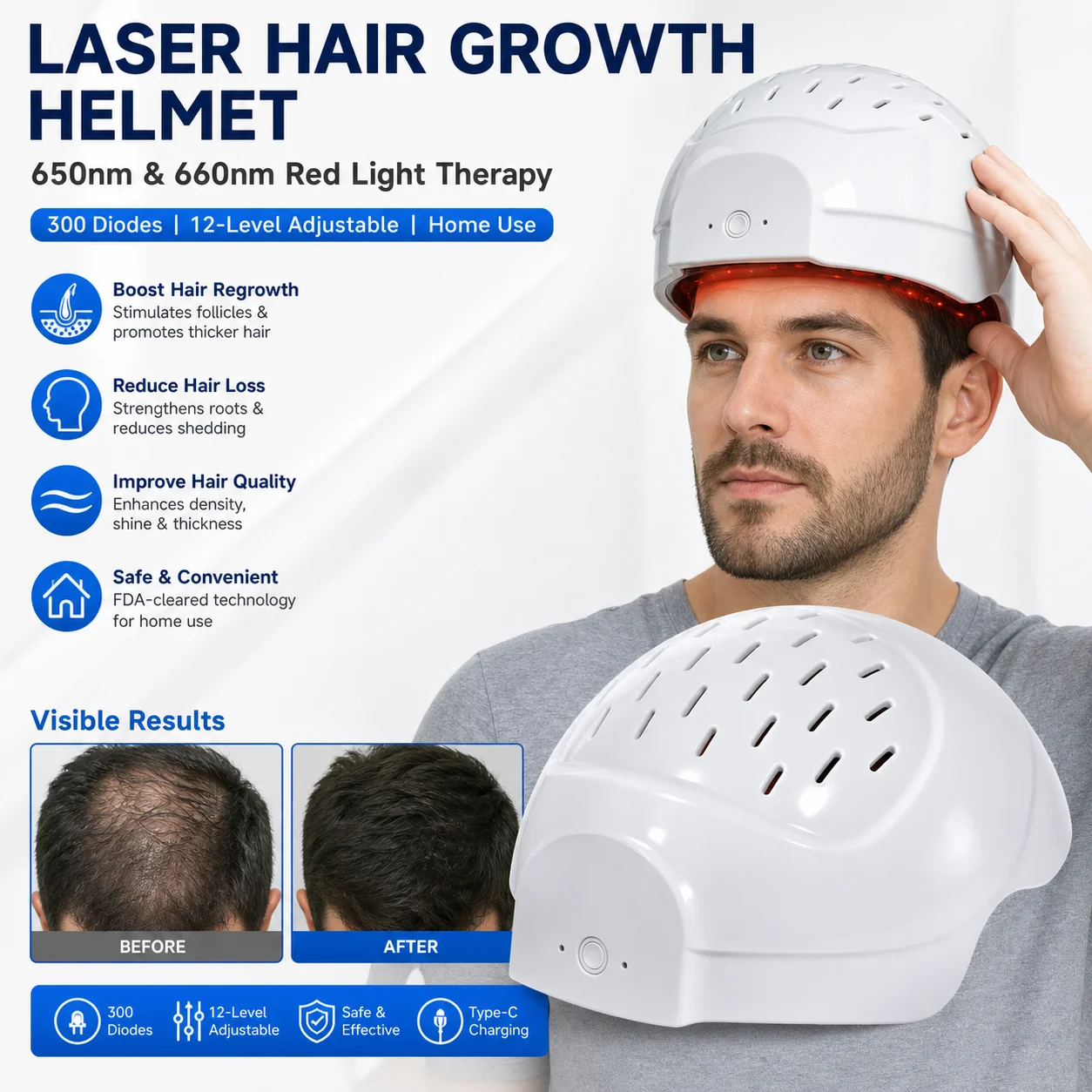 

Portable Hair Regrowth Laser Cap COZING-C300 Dual Wavelength 6750mW Adjustable Power Type-C 650nm 660nm LLLT Therapy Cap