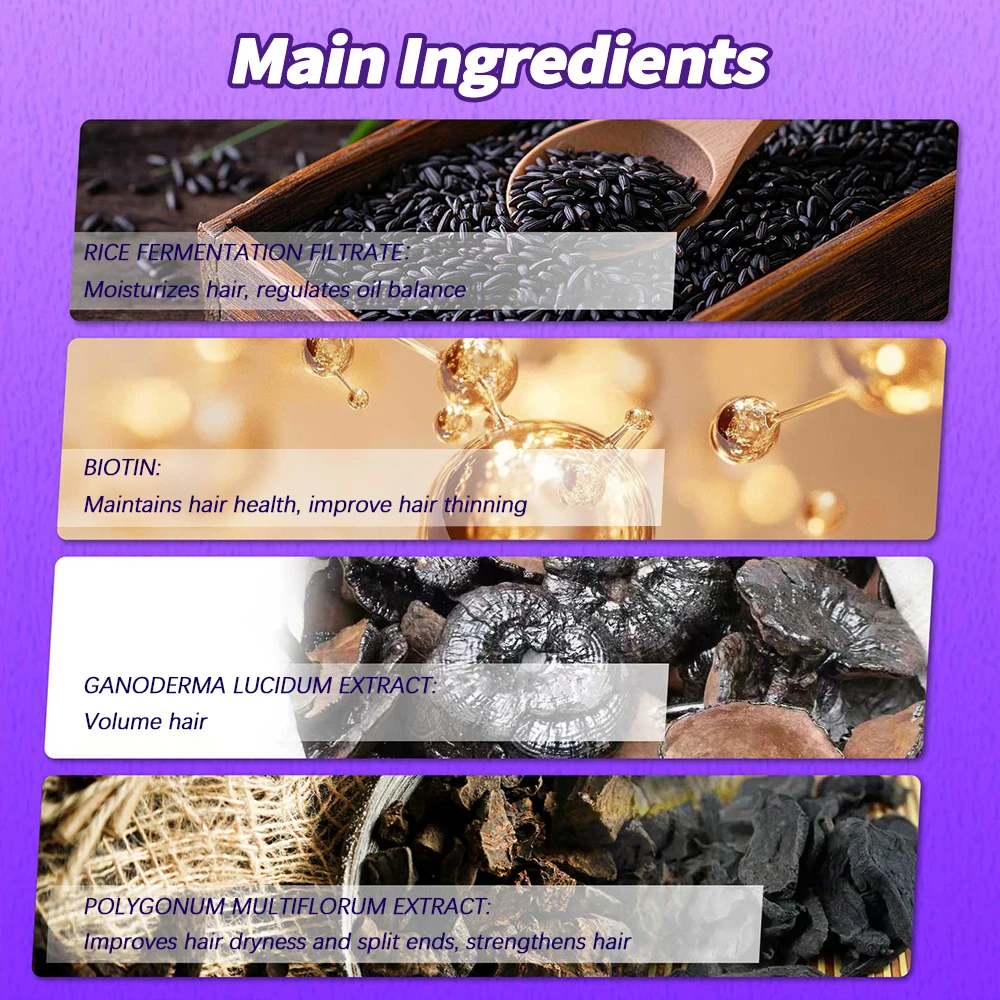 빠른 모발 성장 탈모 방지 오일, 생강 에센셜 하이 헤어 라인 헤드 헤어 세럼, 무모 대머리 증가 에센스 크림, 60ml