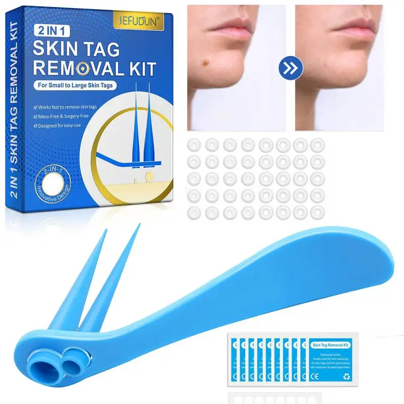 

Remove Skin Tags Skin Tags Removal Tool With Two Cones 2mm 9mm Wart Removal Devices For Face Neck Hands Back Feet Easily Use And