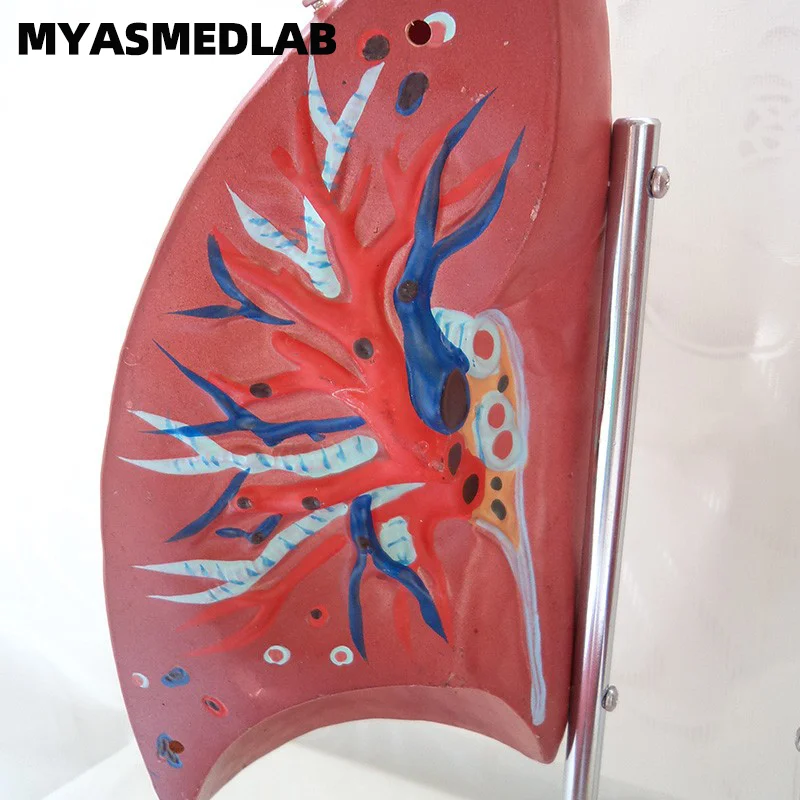 Human Lung Anatomy Model, Lung Dissection Specimen