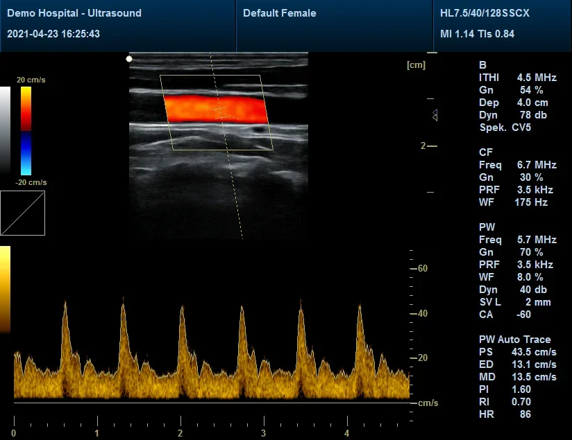 New Waterproof Ultrasonido Scanner Probe Handheld USB ultrasound Convex probe