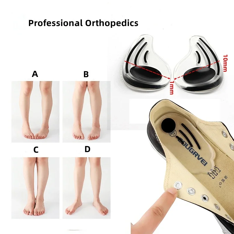 Silicone Orthopedic Insole for Feet O/X Leg Type Valgus Varus Correction Plantar Fasciitis Gel Heel Pad Magnet Massage Foot Care