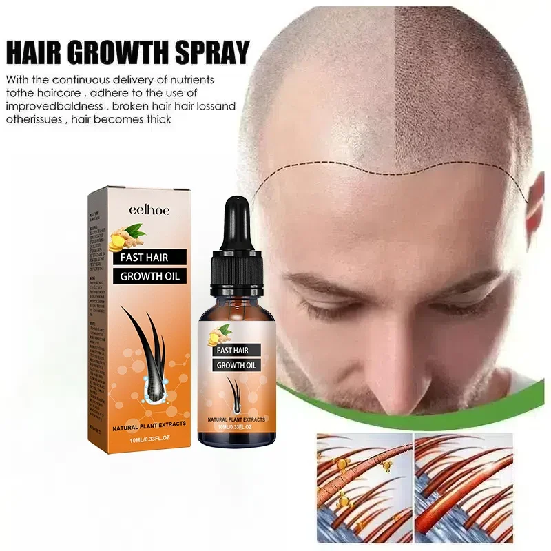 MAN Hair care Repairs Nourishes Damaged Scalp Fast Hair Growth Hair growth products