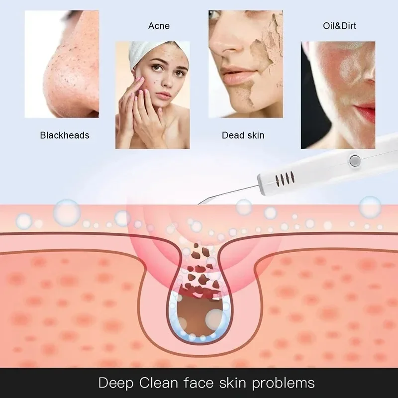 قوية بالموجات فوق الصوتية الوجه الجلد الغسيل للتنظيف العميق البثرة حب الشباب البقع مزيل المنزل المستخدمة الجمال أداة جهاز العناية بالبشرة