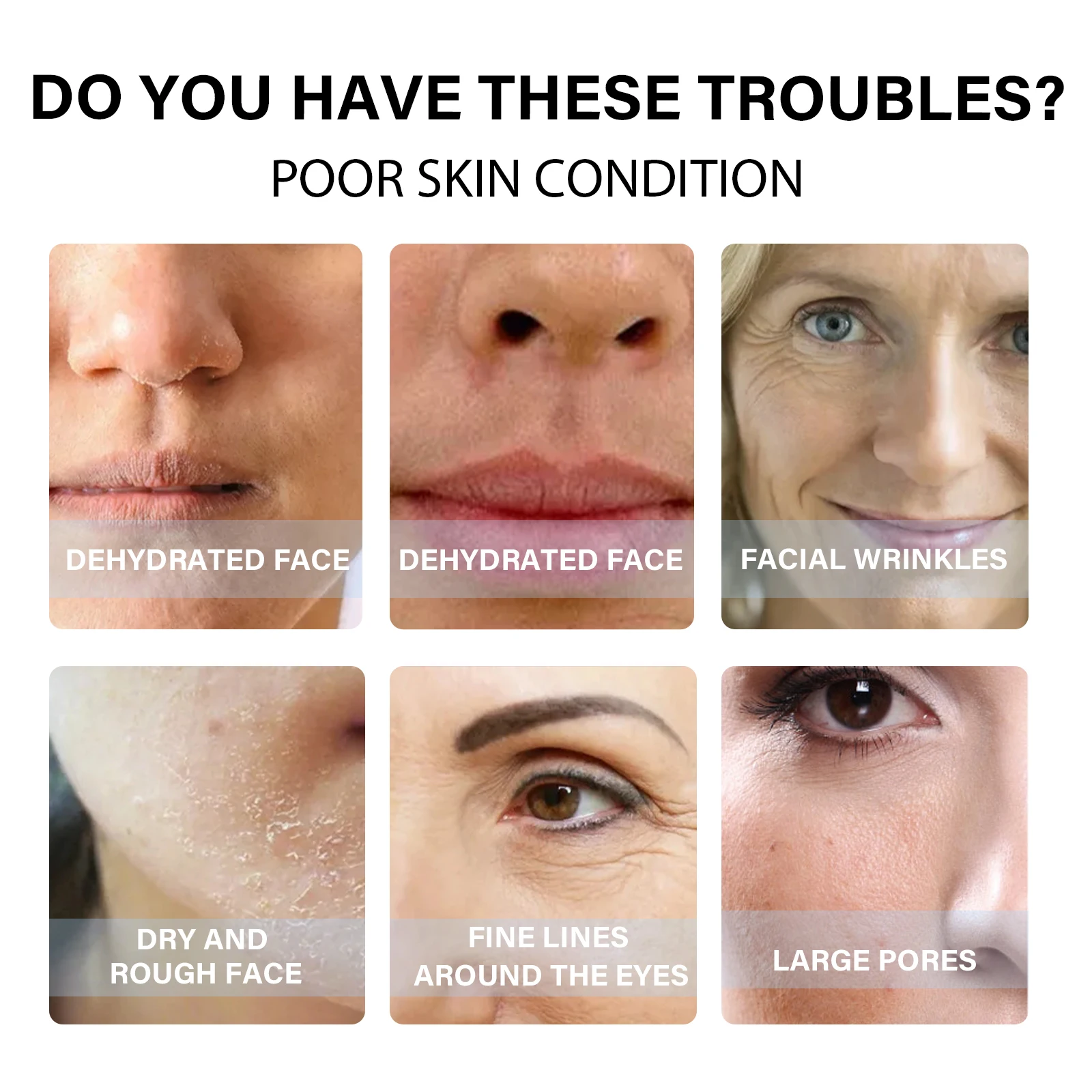 コラーゲン糸 フェイスリフト 肌の引き締め 若返り 小じわの改善 顔の栄養補給 深層修復 肌の引き締め プロテインライン