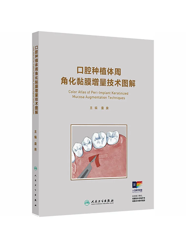 

Иллюстрированное руководство Book-Winshare по перимплантационной угловой кератозите и техникам аугментации слизистой оболочки