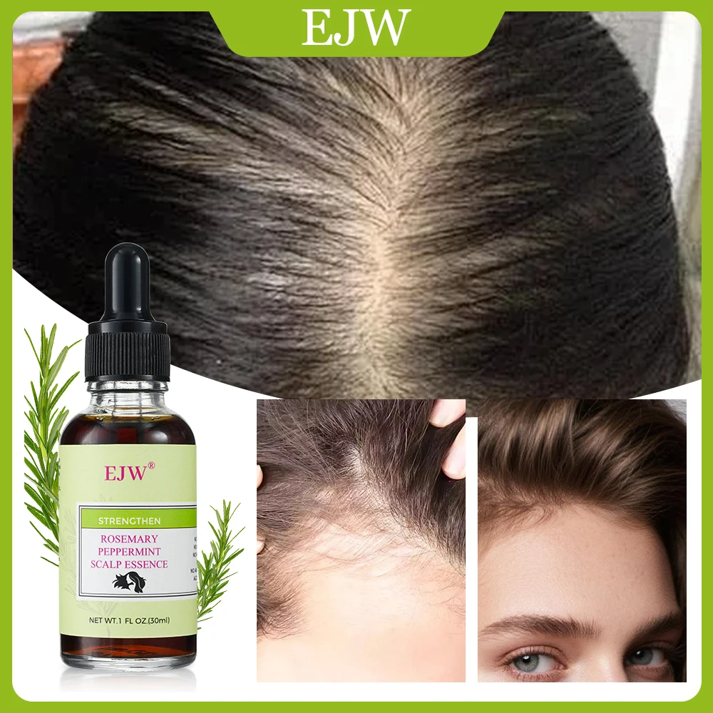 

Масло розмарина EJW для роста волос | Уход за кожей головы с использованием розмарина и мяты перечной | Питание кожи головы и снятие сухости | Для всех типов волос