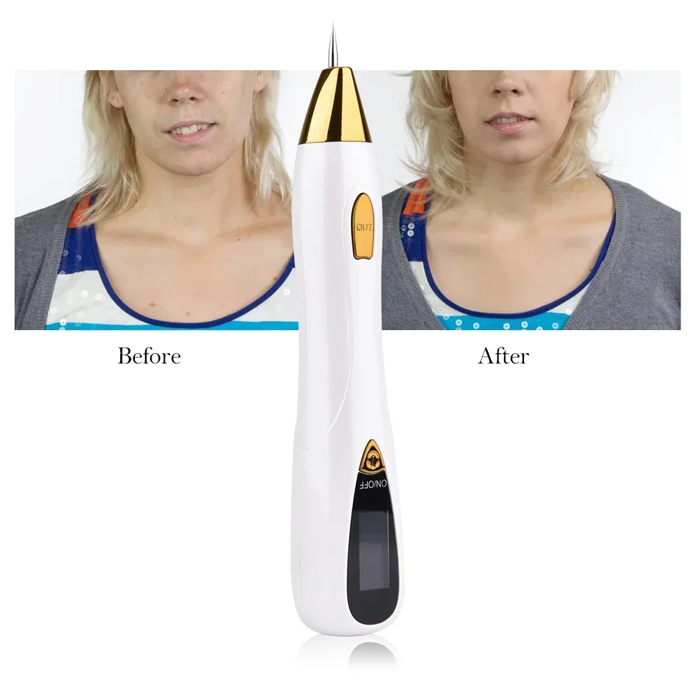 Stylo à plasma électrique pour les soins de la peau, outils pour enlever les taches foncées, les grains de rousseur, les tatouages, les taches noires, le visage